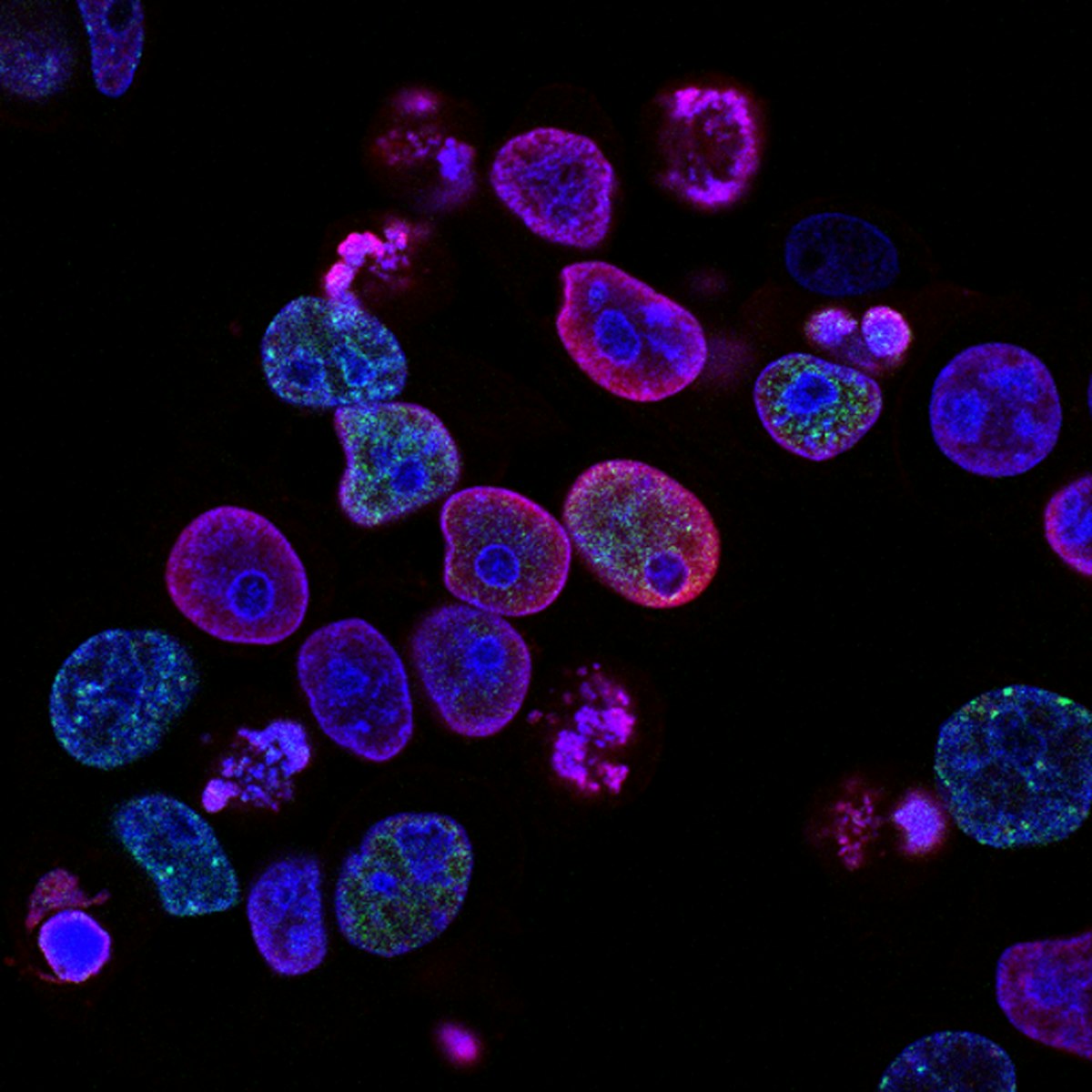 Senolytics: Clearing Out the Zombie Cells